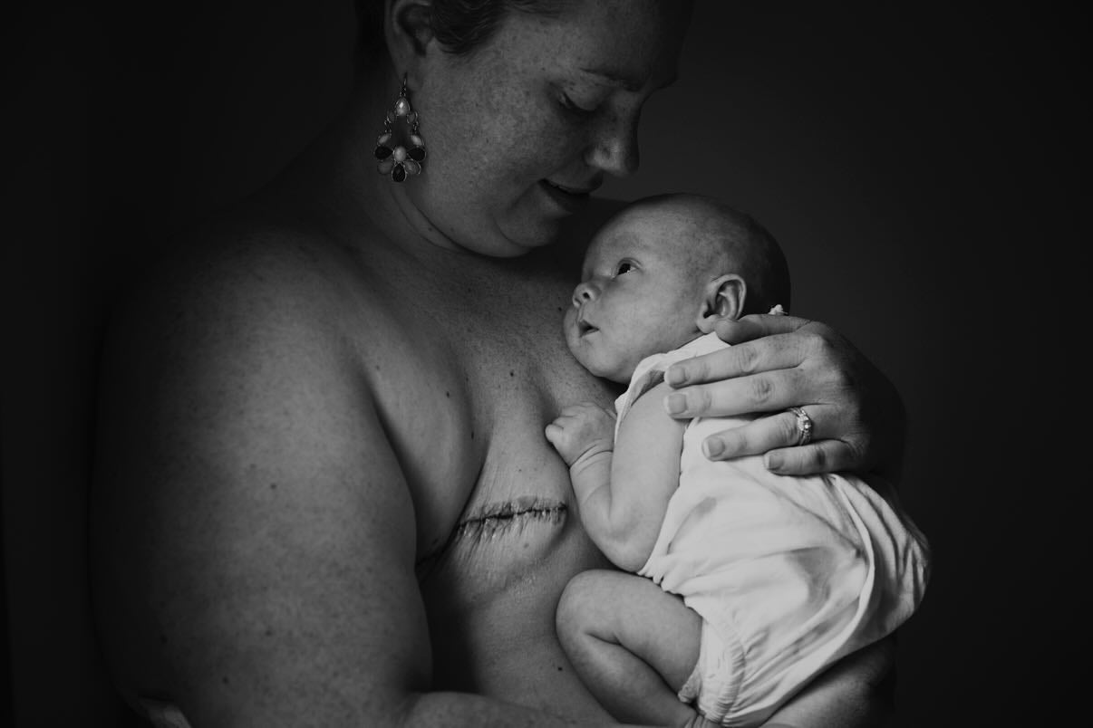 Breast Cancer During Pregnancy: Mandy’s Story of Finding Support