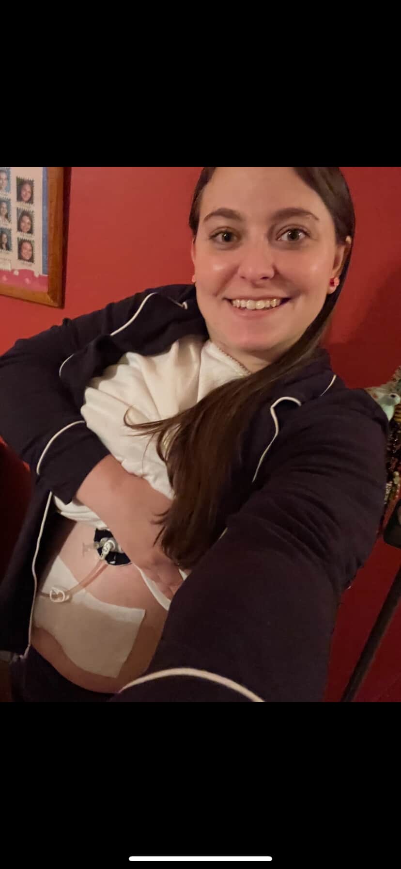 Finding Rhythm in Care: Erica’s Life With a Feeding Tube