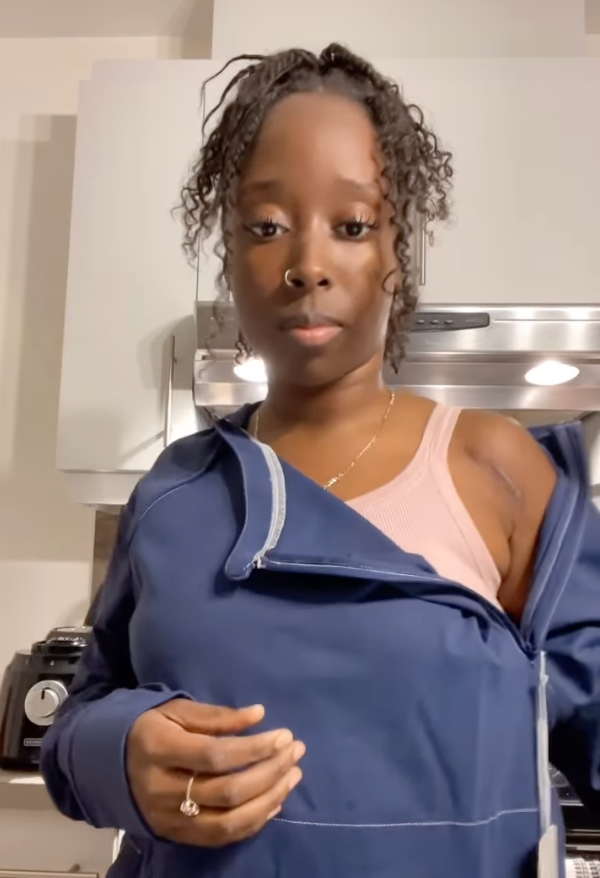 Comfort Amidst Challenges: Navigating Life with Sickle Cell