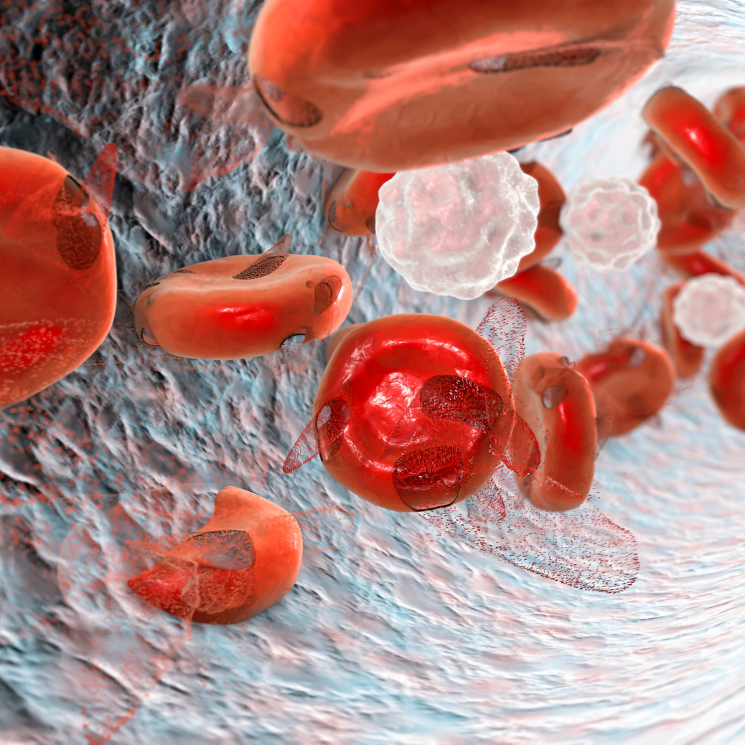 Understanding Sickle Cell Disease: Symptoms, Treatment, and Support
