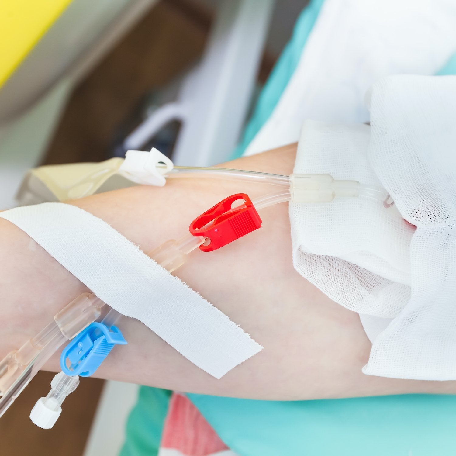 What is Vascular Access? | Care+Wear