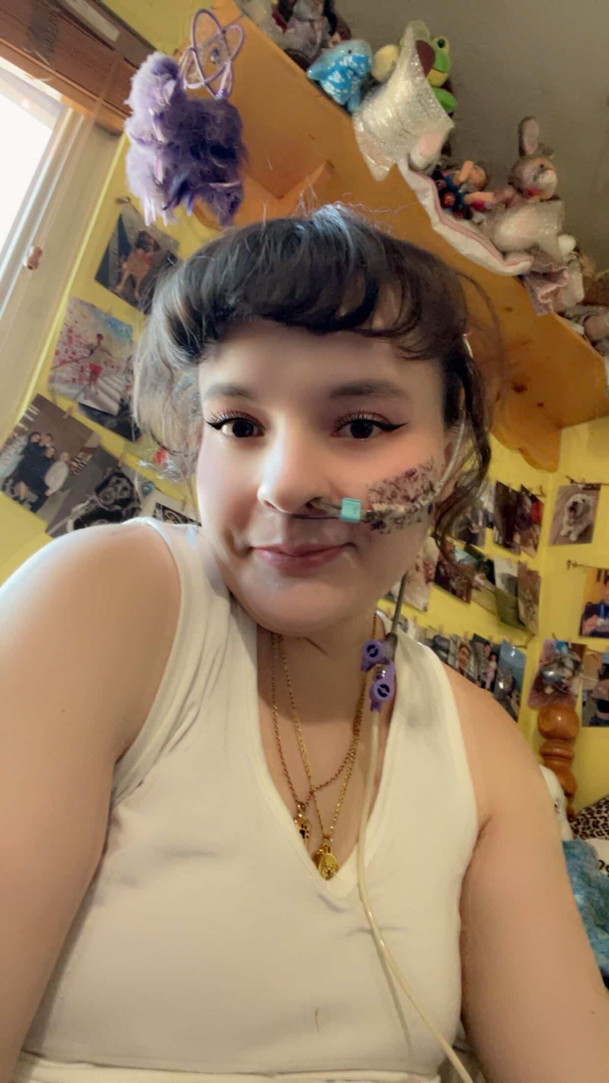 Living With a Feeding Tube: Katie's Story