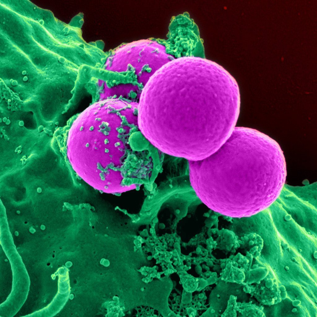 Immunotherapy 101 | Care+Wear